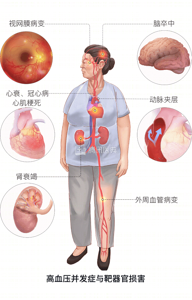 d7b226eb63e46a898db266f03bd2e854.png